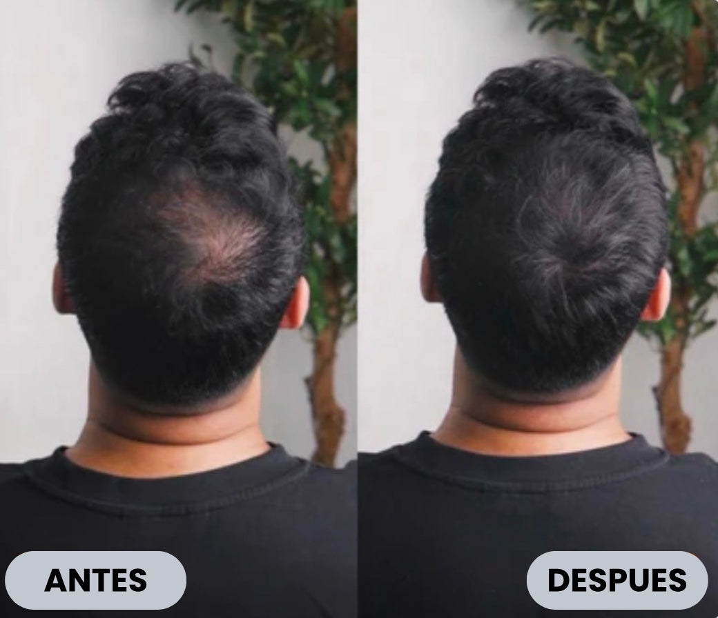 Camuflaje capilar