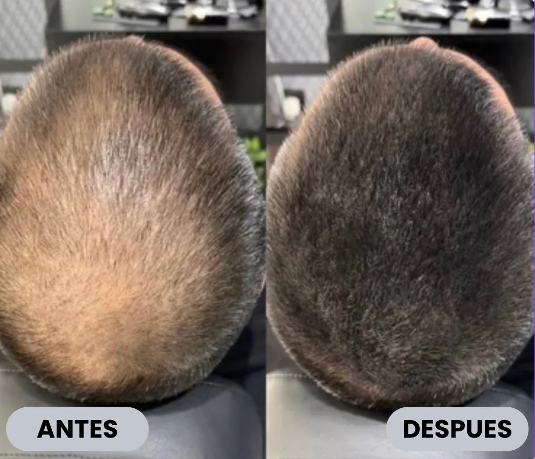 Camuflaje capilar