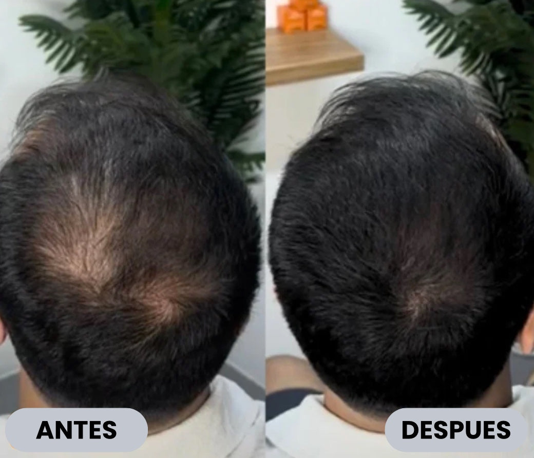 Camuflaje capilar