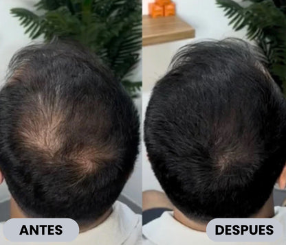 Camuflaje capilar